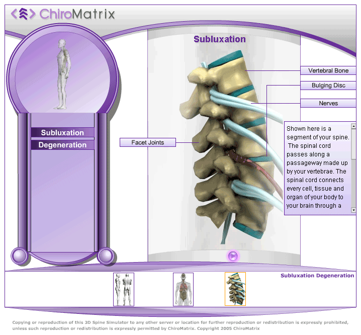 Chiropractic Websites And Marketing Services ChiroMatrix 3D Spine Simulator